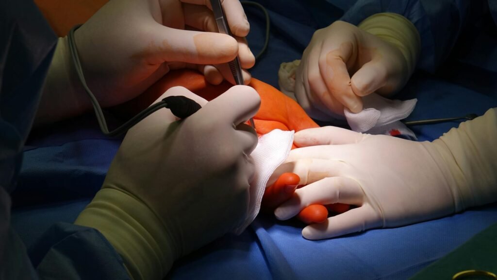 SUS incorpora transplante de membrana amniótica para tratar pé diabético e lesões oculares