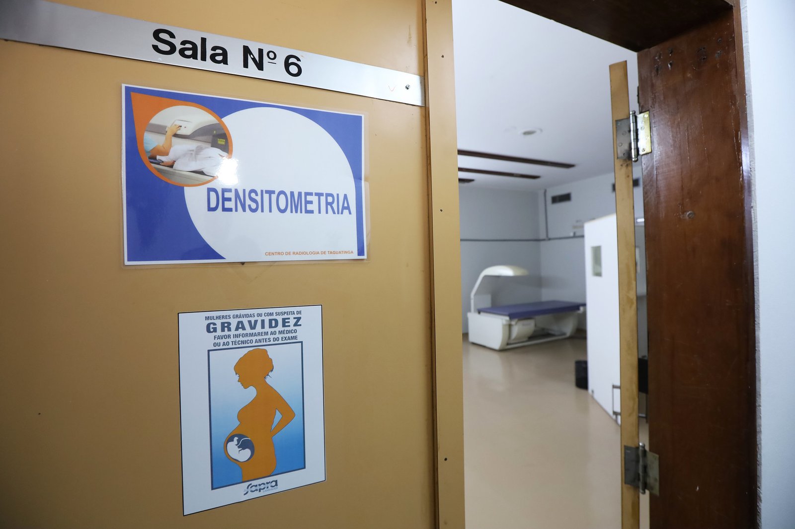Central de Radiologia de Taguatinga passa a oferecer densitometria óssea pelo SUS