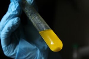 Pesquisa da UnB usa oleo de pequi e nanotecnologia em pe diabetico