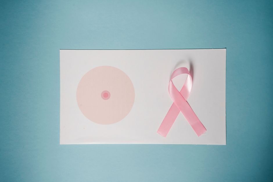 Mamografia e preventivo no SUS do DF: quando fazer