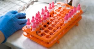 Rack de laboratório com tubos de coleta e mão com luva descartável