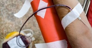 Braço de doador com agulha fixada por esparadrapo e bolsa de coleta de sangue
