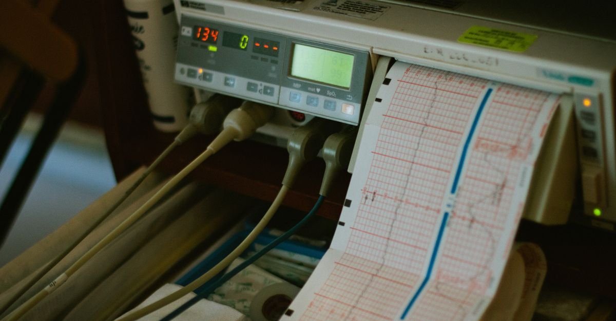 Monitor hospitalar com traçado de eletrocardiograma impresso em papel milimetrado