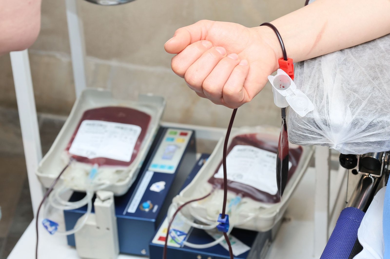Braço de doador com bolsas de sangue em coleta, em banco de sangue