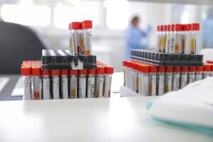 Bandejas com tubos de coleta de sangue identificados por etiquetas e códigos de barras sobre bancada de laboratório de análises clínicas