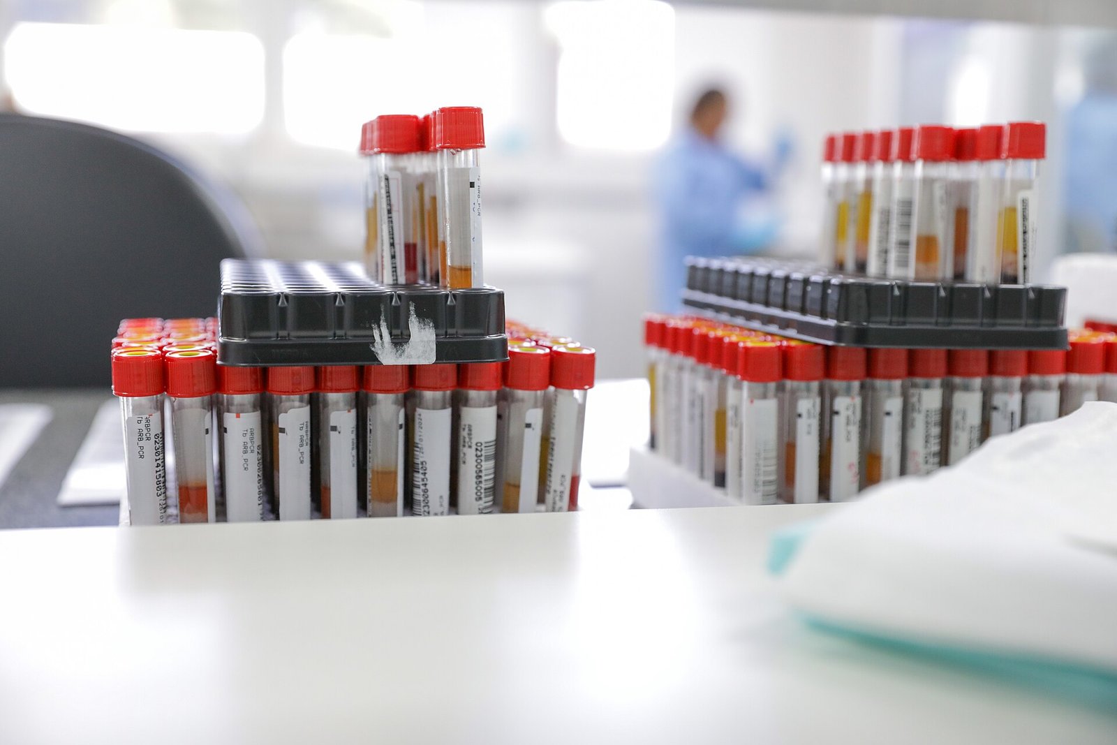 Bandejas com tubos de coleta de sangue identificados por etiquetas e códigos de barras sobre bancada de laboratório de análises clínicas