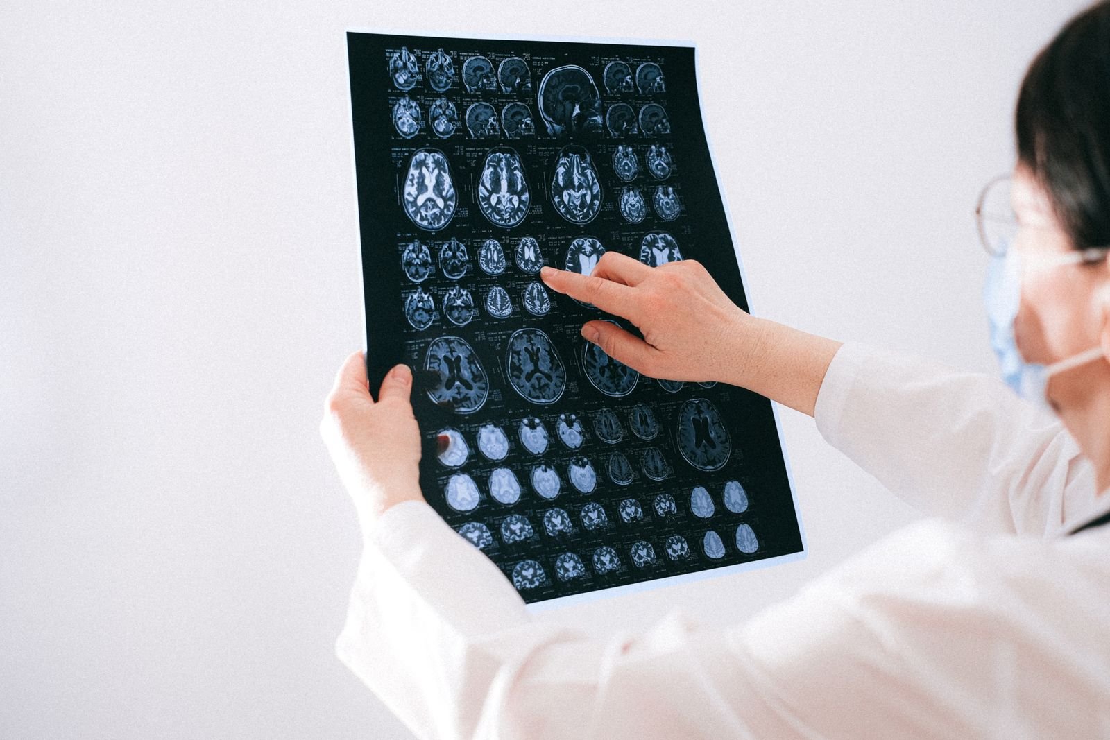 Médica aponta para exames de ressonância magnética do cérebro impressos em uma chapa