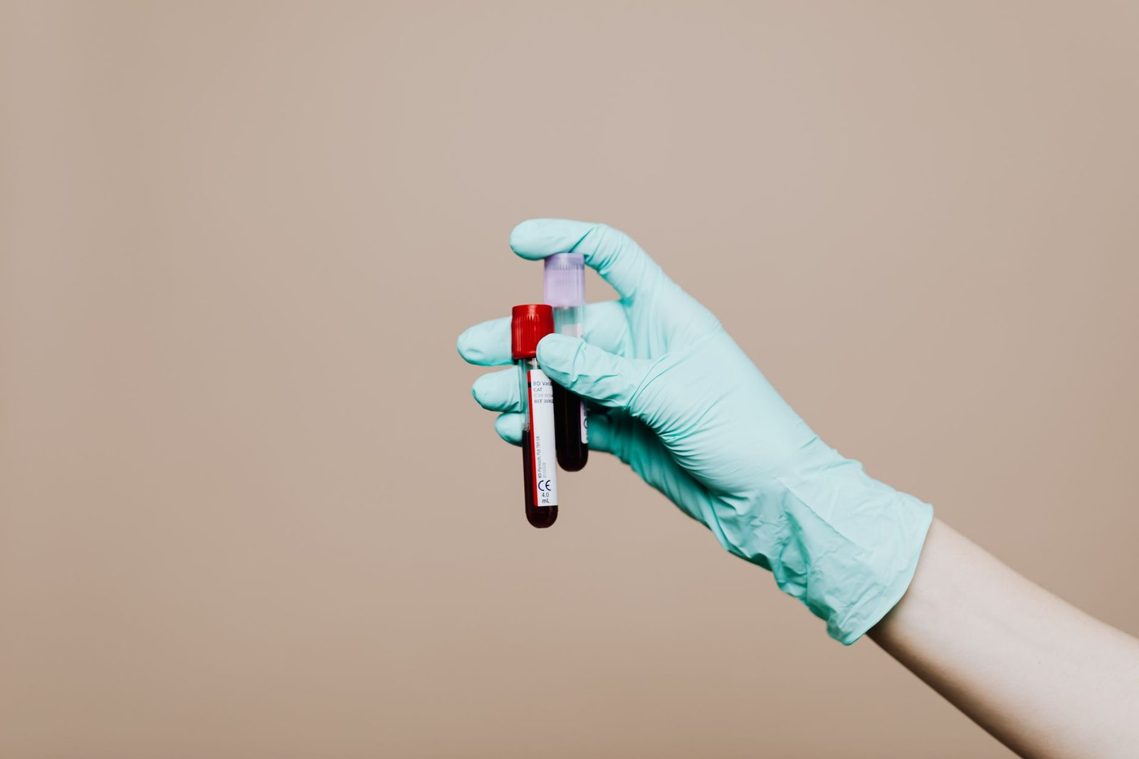 Mão com luva azul segurando dois tubos de coleta de sangue