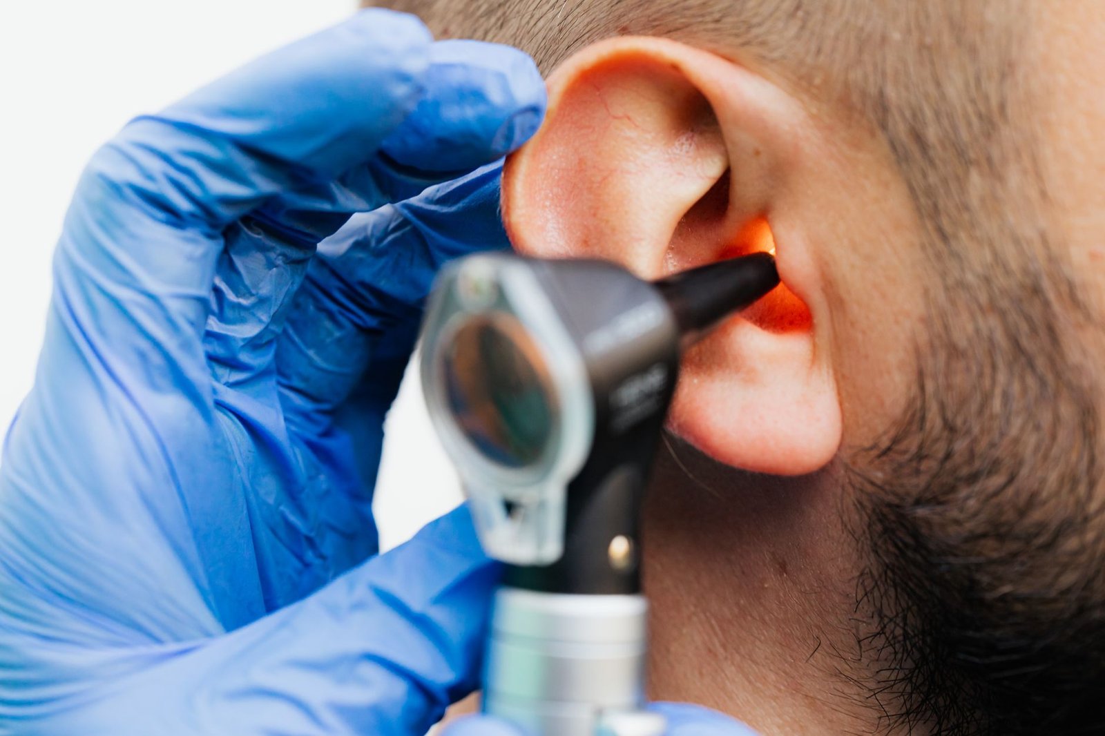Médico com luva azul examina o ouvido de um paciente com otoscópio, foto ilustrativa