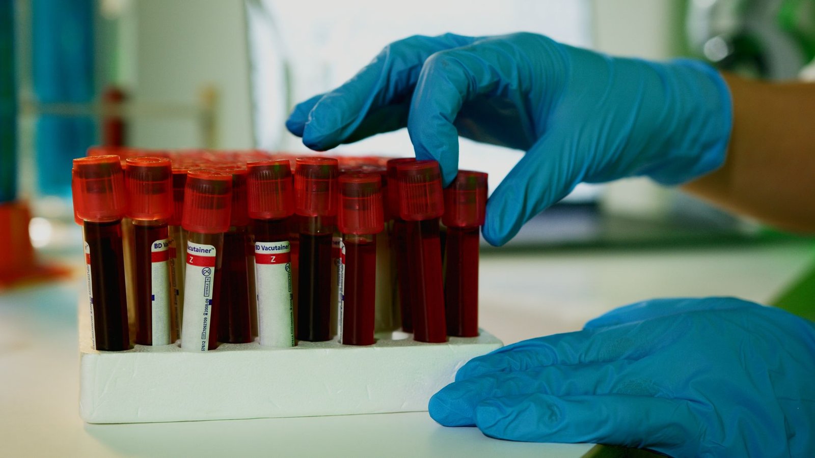 Mãos de luvas azuis organizam tubos de coleta de sangue em suporte de laboratório